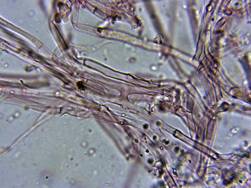Ceriporia purpurea 11 - Hifas contexto 2